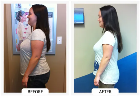 Healthy Lifestyle Support | Lakeside Spine And Wellness June 15, 2026 Chiropractic-renton-wa-angelica-before-after