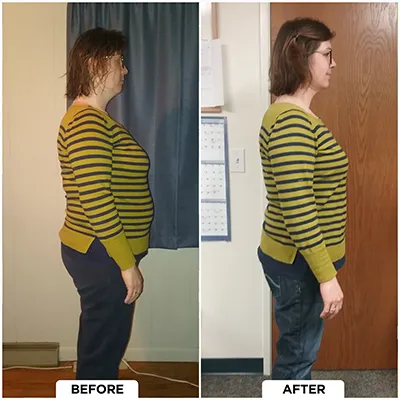 Healthy Lifestyle Support | Lakeside Spine And Wellness June 15, 2026 Chiropractic-renton-wa-before-after