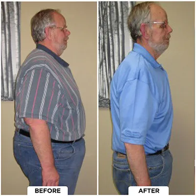Healthy Lifestyle Support | Lakeside Spine And Wellness June 15, 2026 Chiropractic-renton-wa-blue-shirt-before-after
