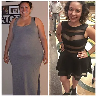 Healthy Lifestyle Support | Lakeside Spine And Wellness June 15, 2026 Chiropractic-renton-wa-confident-before-after