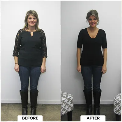 Healthy Lifestyle Support | Lakeside Spine And Wellness June 15, 2026 Chiropractic-renton-wa-lady-before-after