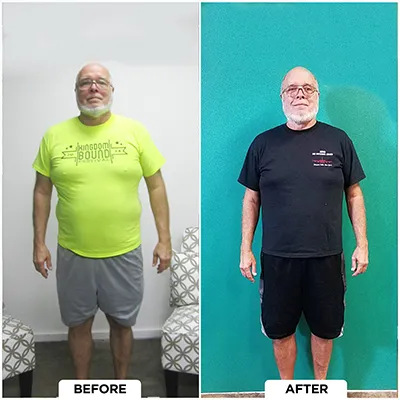 Healthy Lifestyle Support | Lakeside Spine And Wellness June 15, 2026 Chiropractic-renton-wa-male-before-after