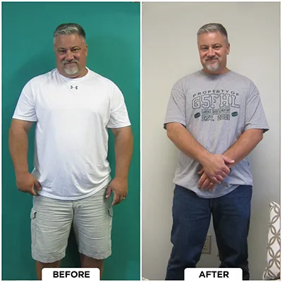 Healthy Lifestyle Support | Lakeside Spine And Wellness June 15, 2026 Chiropractic-renton-wa-man-before-after