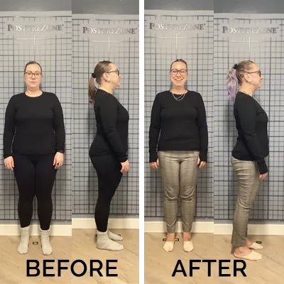 Healthy Lifestyle Support | Lakeside Spine And Wellness June 15, 2026 Chiropractic-renton-wa-new-before-after