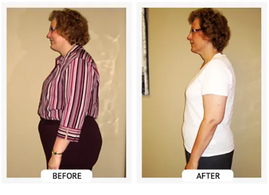 Healthy Lifestyle Support | Lakeside Spine And Wellness June 15, 2026 Chiropractic-renton-wa-sherry-before-after