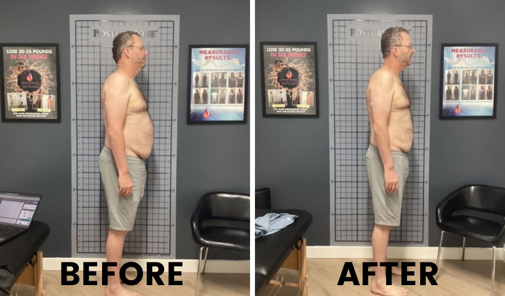 Healthy Lifestyle Support | Lakeside Spine And Wellness June 15, 2026 Weight loss